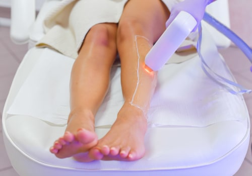 The Truth About Laser Hair Removal: An Expert's Perspective