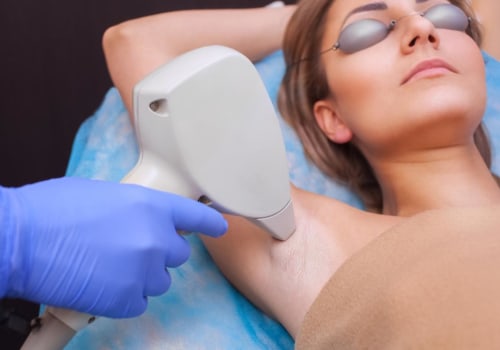 The Truth About Laser Hair Removal: Separating Fact from Fiction