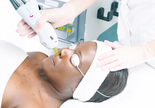 The Truth About Laser Hair Removal: Separating Fact from Fiction