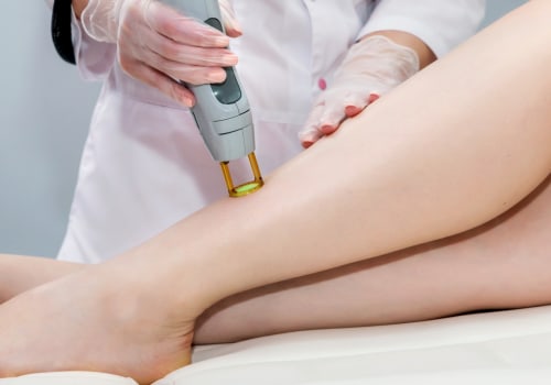 The Ultimate Guide to Choosing Between Laser Hair Removal and Waxing