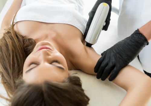 The Ultimate Guide to Painless Laser Hair Removal