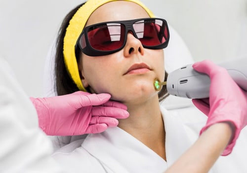 The Truth About Laser Hair Removal: Debunking the Myth of Permanence